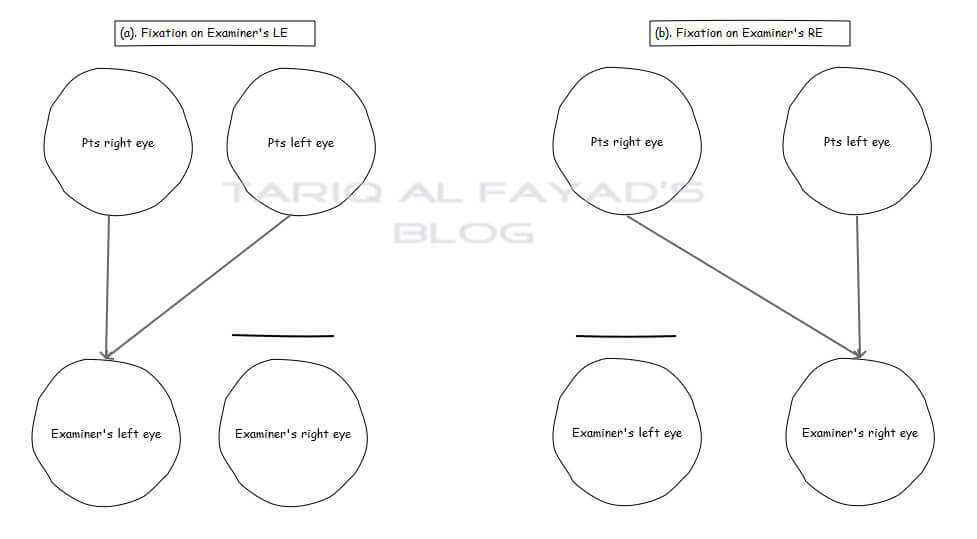 [[a]  Messung der Nah-PD. [a & b] Abstandsmessung PD]