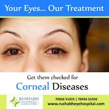 Rushabh Eye Hospital