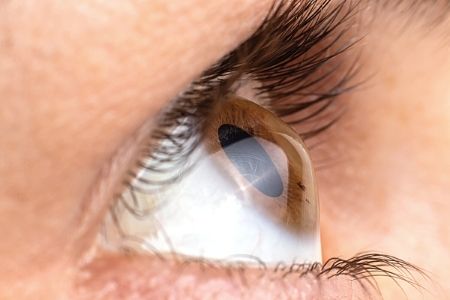 Welche Gesundheitszustände hindern mich daran, LASIK zu erhalten?