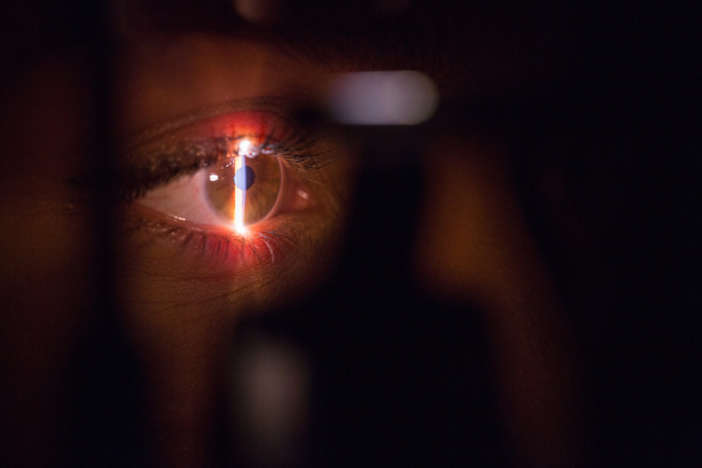 Ein Lichtstrahl, der während einer Augenuntersuchung beim Augenarzt auf ein offenes Auge scheint